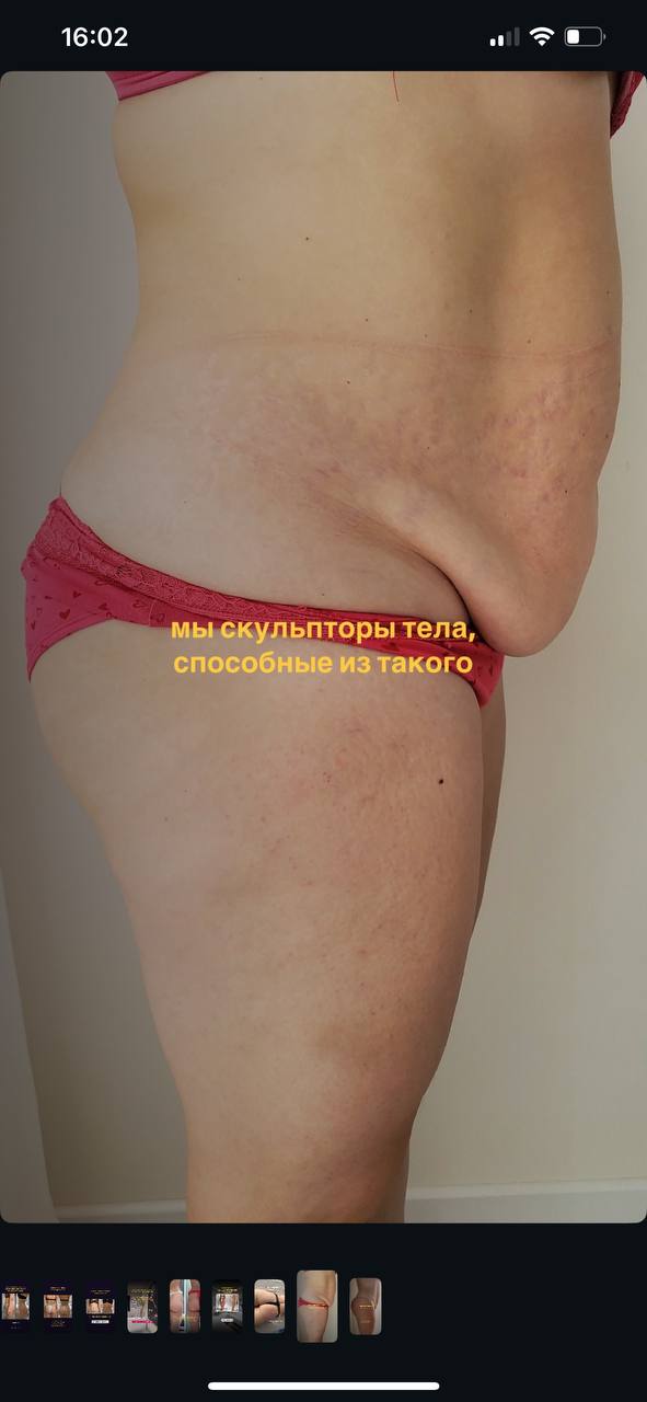 До — Лола